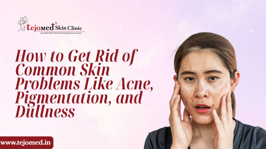 How to Get Rid of Common Skin Problems Like Acne, Pigmentation, and Dullness