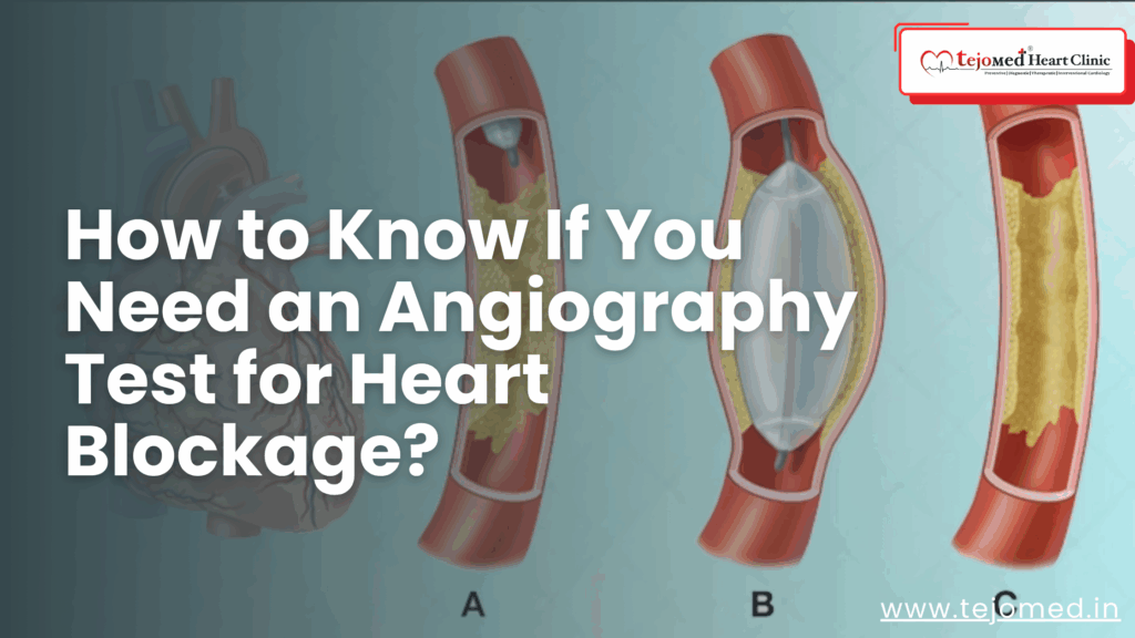 How to Know If You Need an Angiography Test for Heart Blockage?