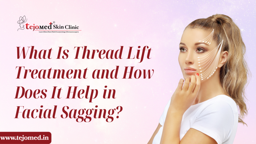 What Is Thread Lift Treatment and How Does It Help in Facial Sagging?