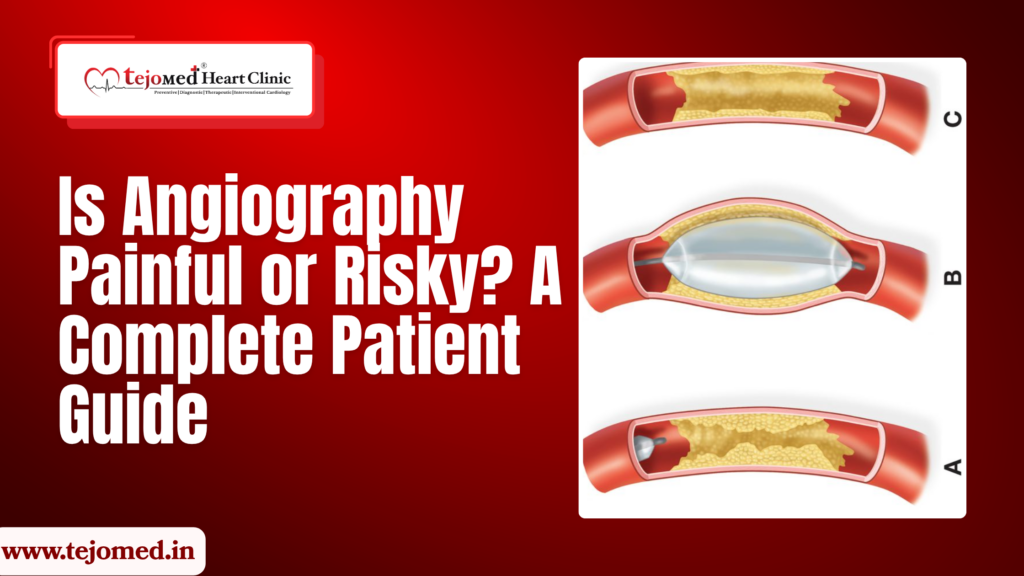 Is Angiography Painful or Risky? A Complete Patient Guide