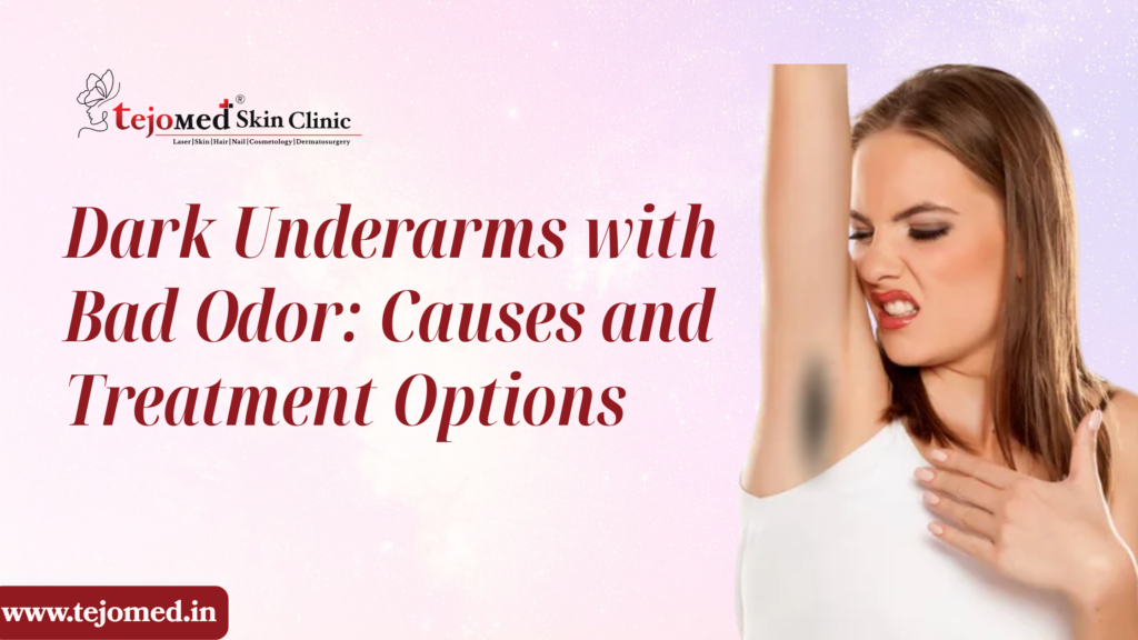 Dark Underarms with Bad Odor: Causes and Treatment Options